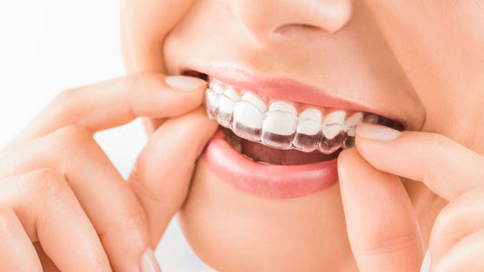 Smile White - Your Dentist Approved Alternative to Smile Direct Club