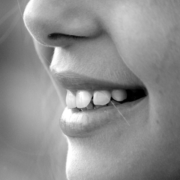 overbite