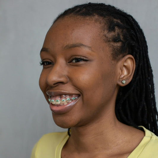 treating overjet with braces