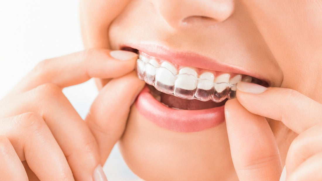 Smile White - Your Dentist Approved Alternative to SmileDirectClub