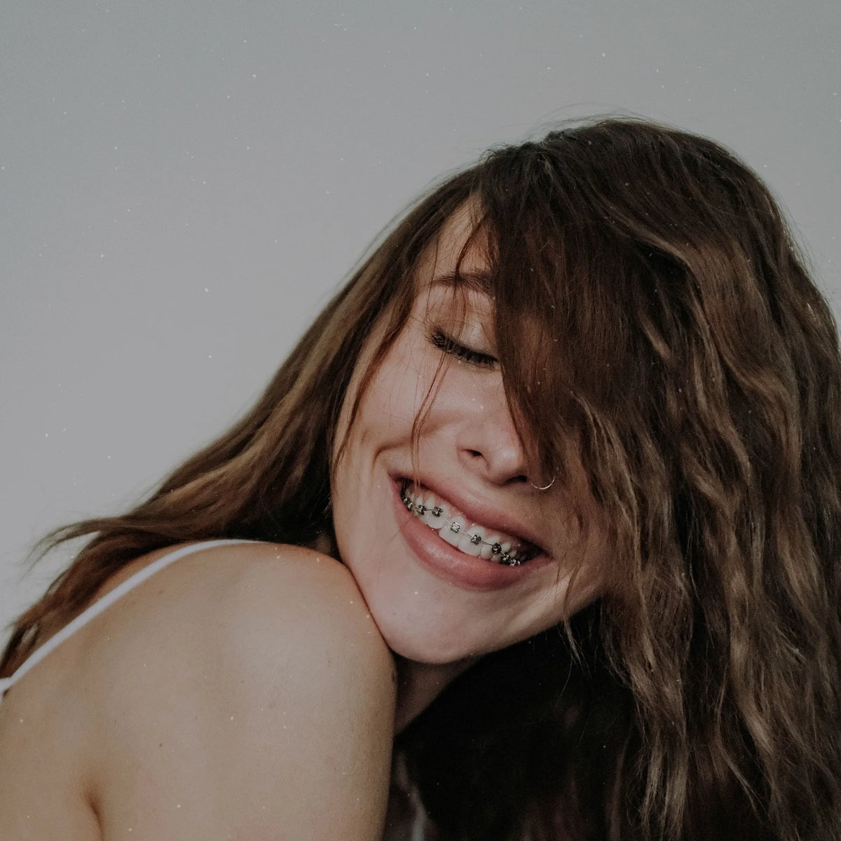 Adult Orthodontics