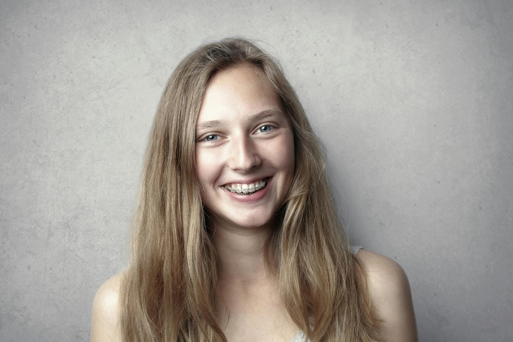 braces vs aligners
