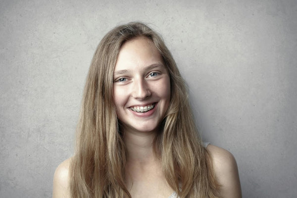 braces vs aligners
