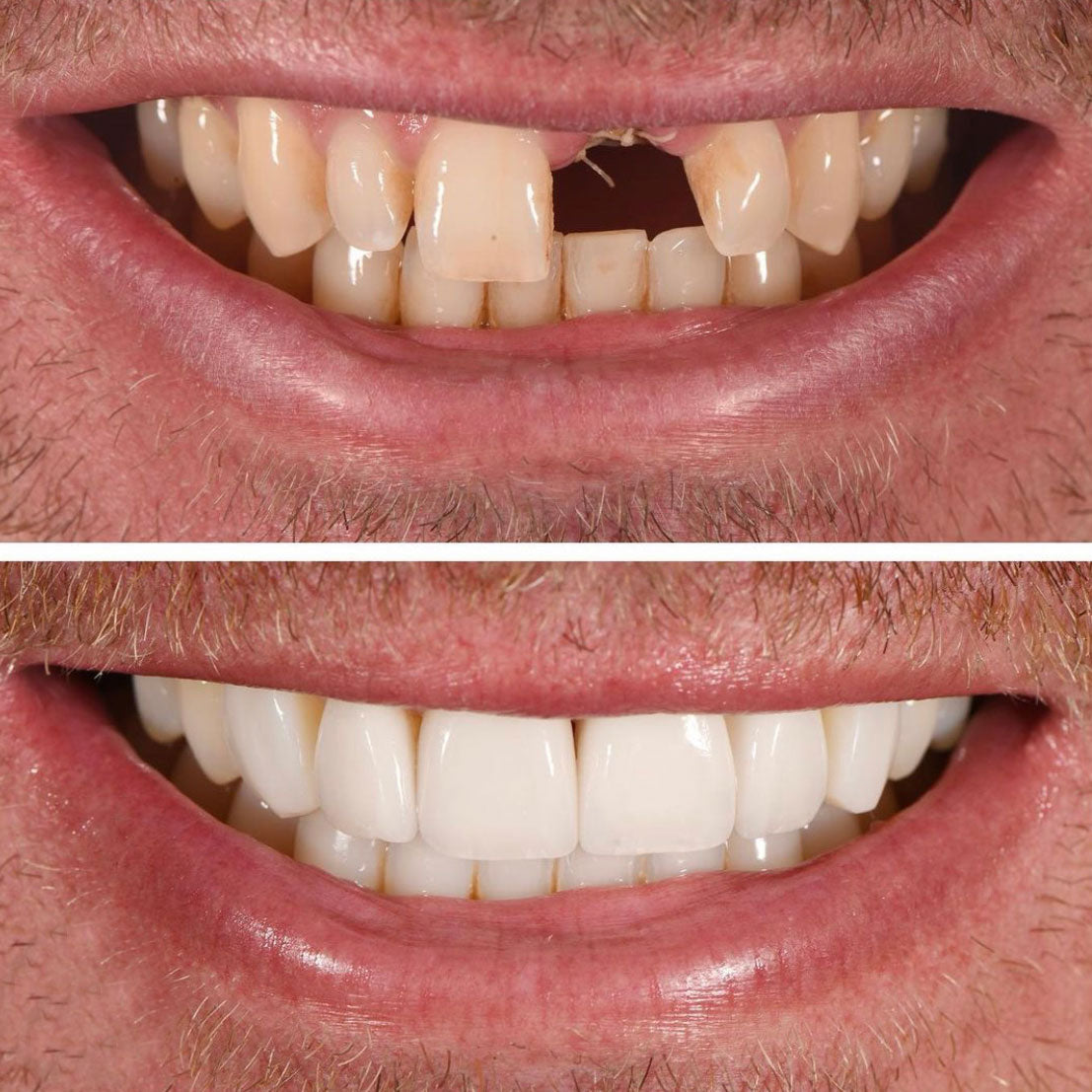 A Beautiful Smile Created With
