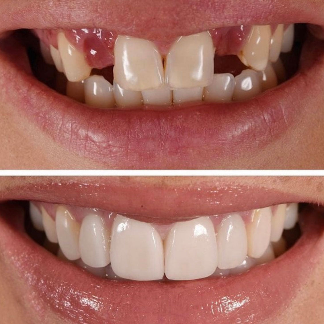 A Beautiful Smile Created With