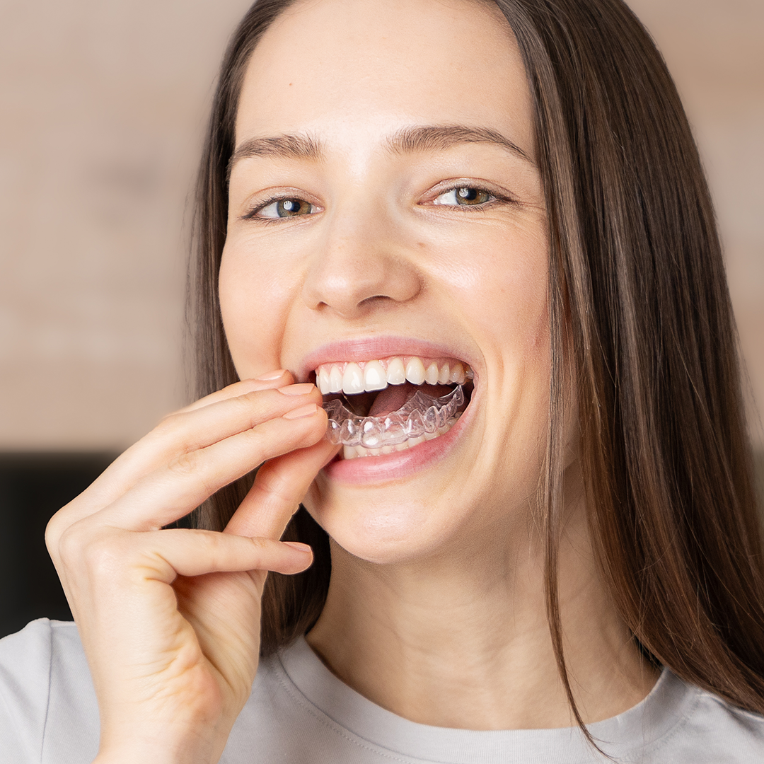Save 10% off dentist delivered whitening, results last 12 months.