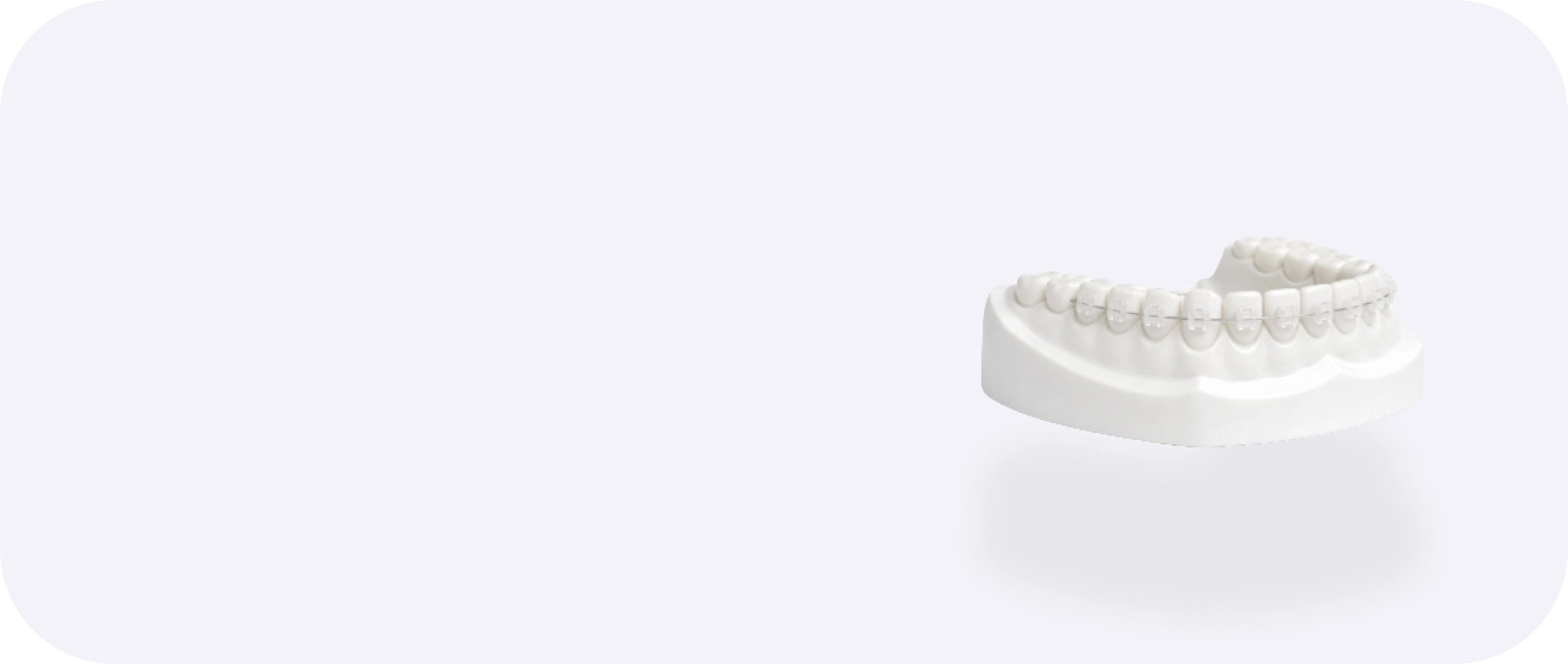 Ceramic braces