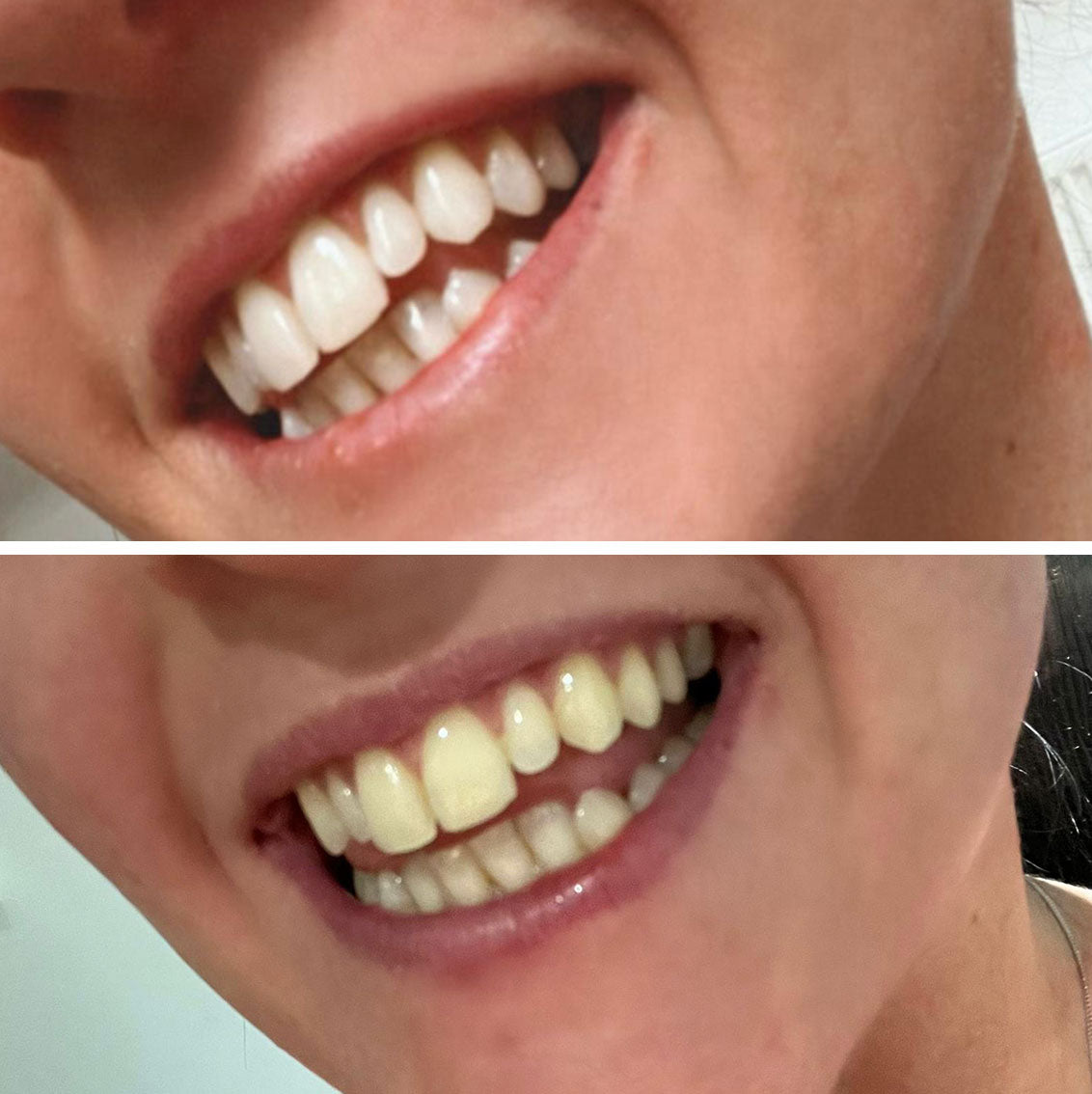 A Beautiful Smile Created With