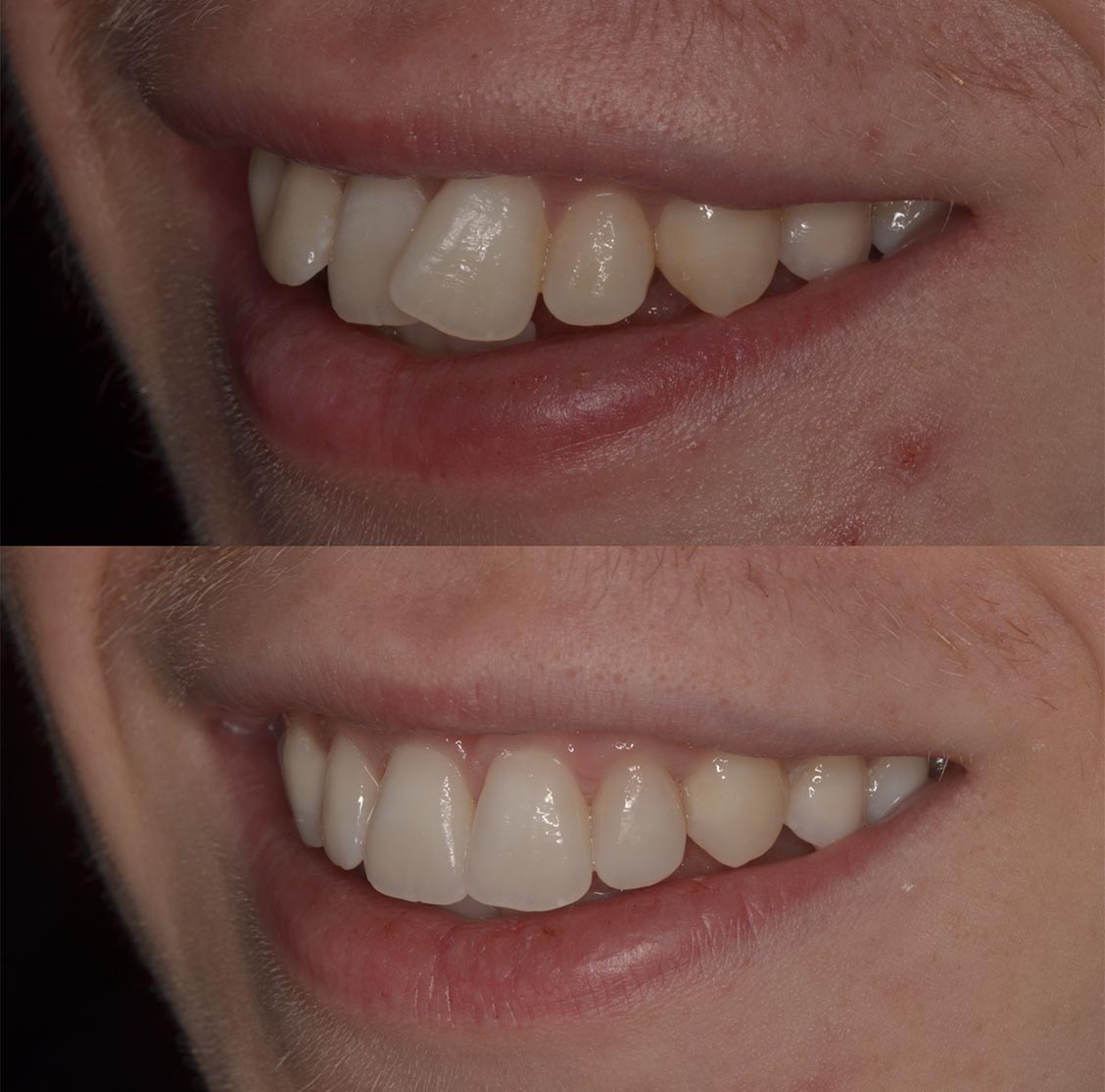 A Beautiful Smile Created With