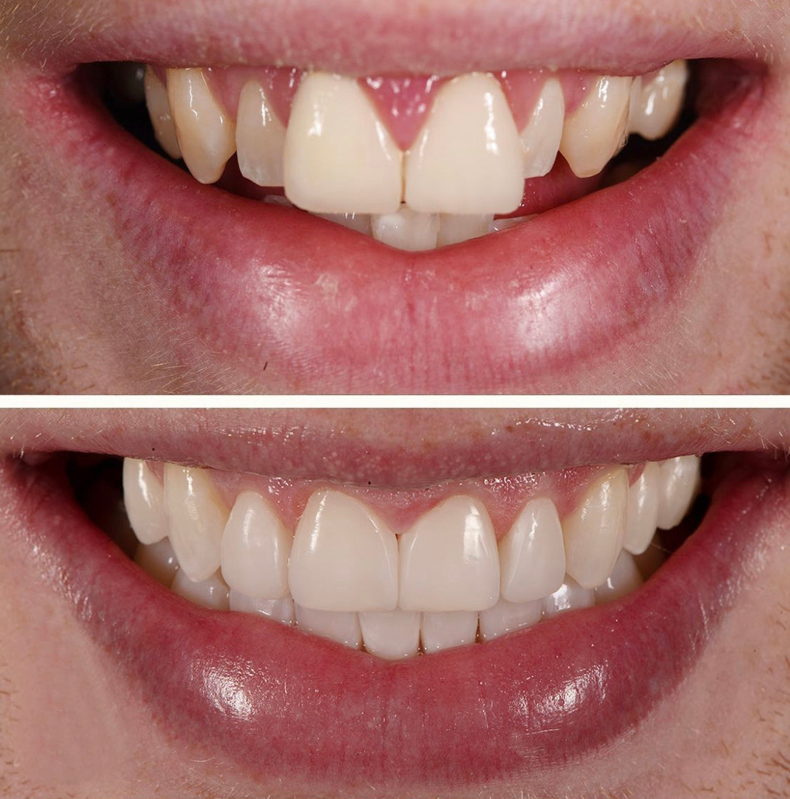 A Beautiful Smile Created With