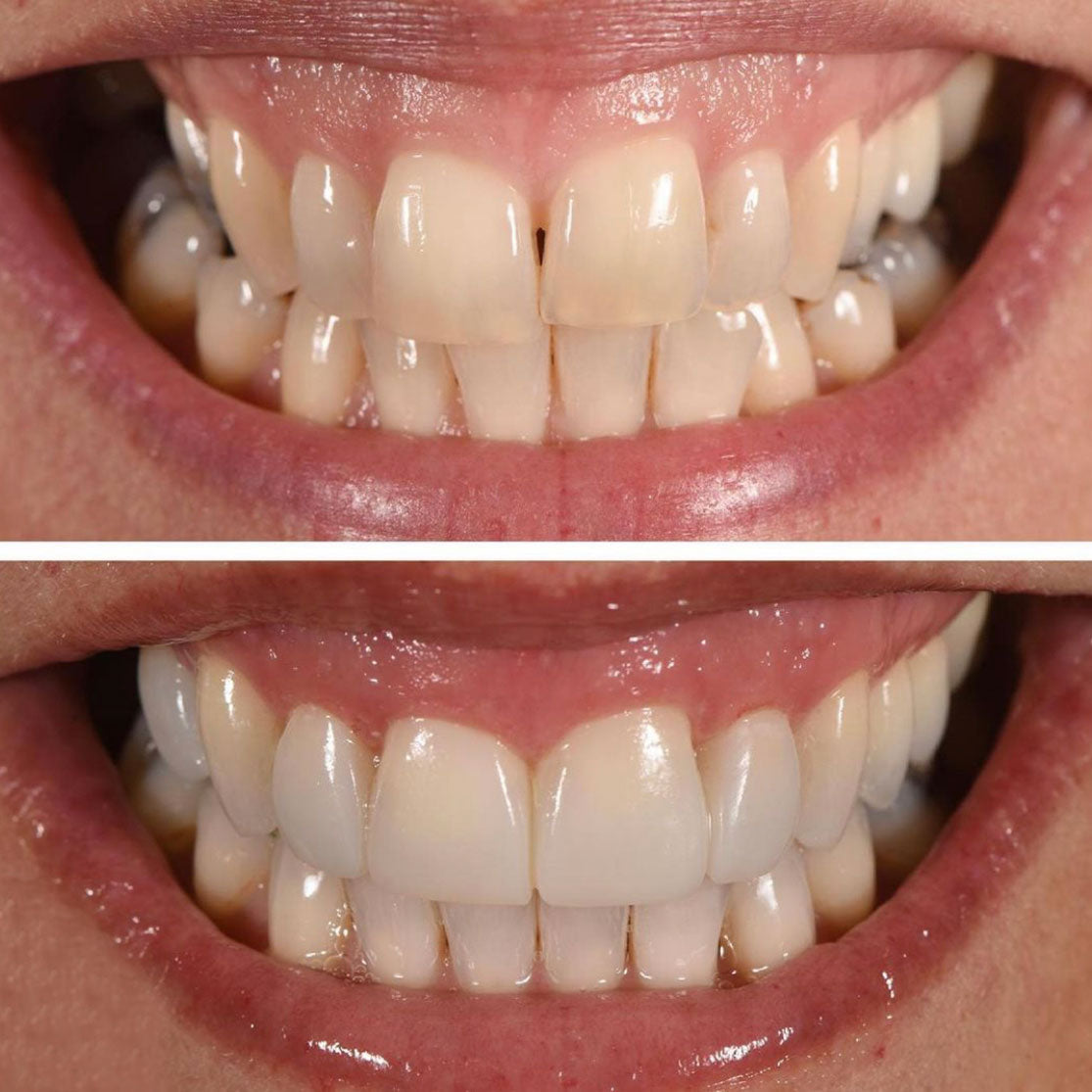 A Beautiful Smile Created With