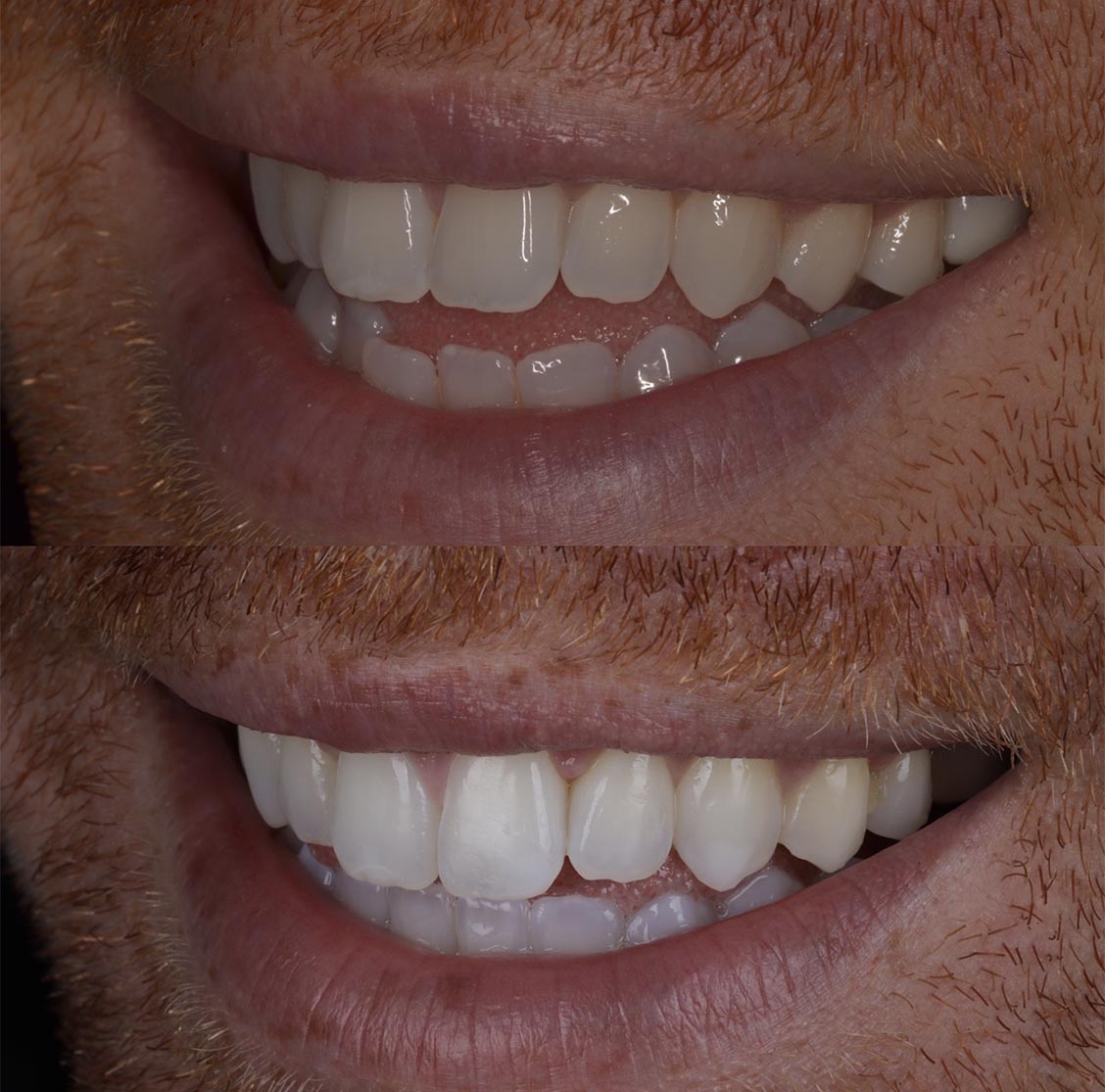 A Beautiful Smile Created With