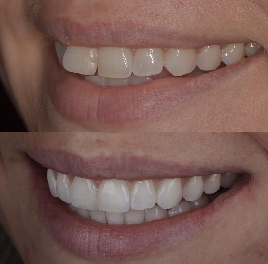 A Beautiful Smile Created With
