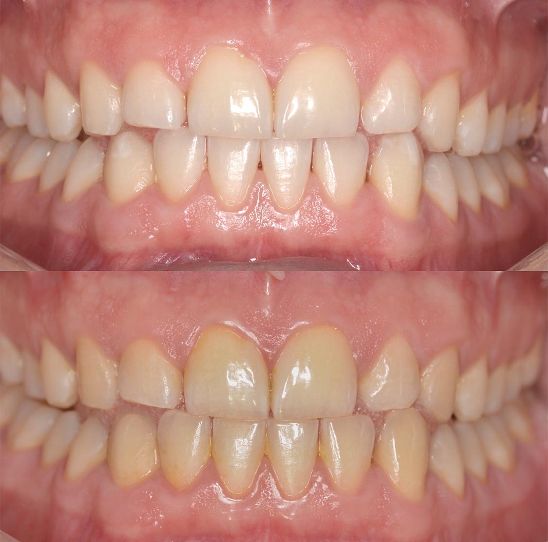 A Beautiful Smile Created With