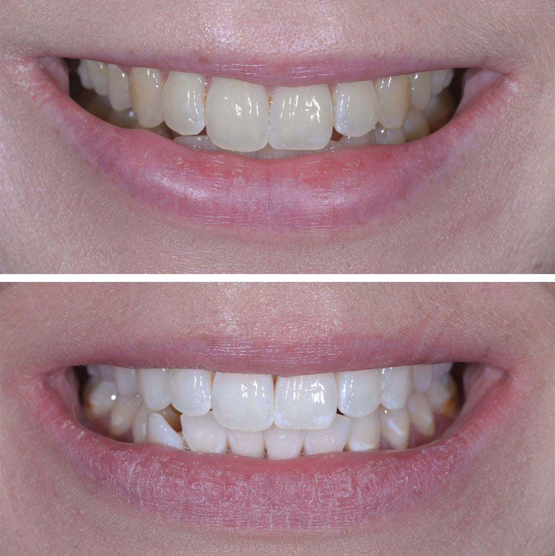 A Beautiful Smile Created With