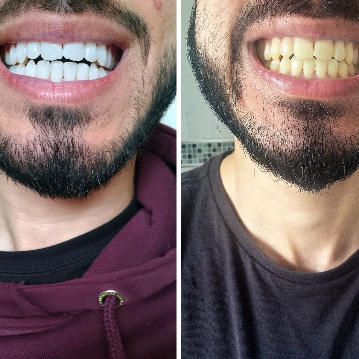 A Beautiful Smile Created With