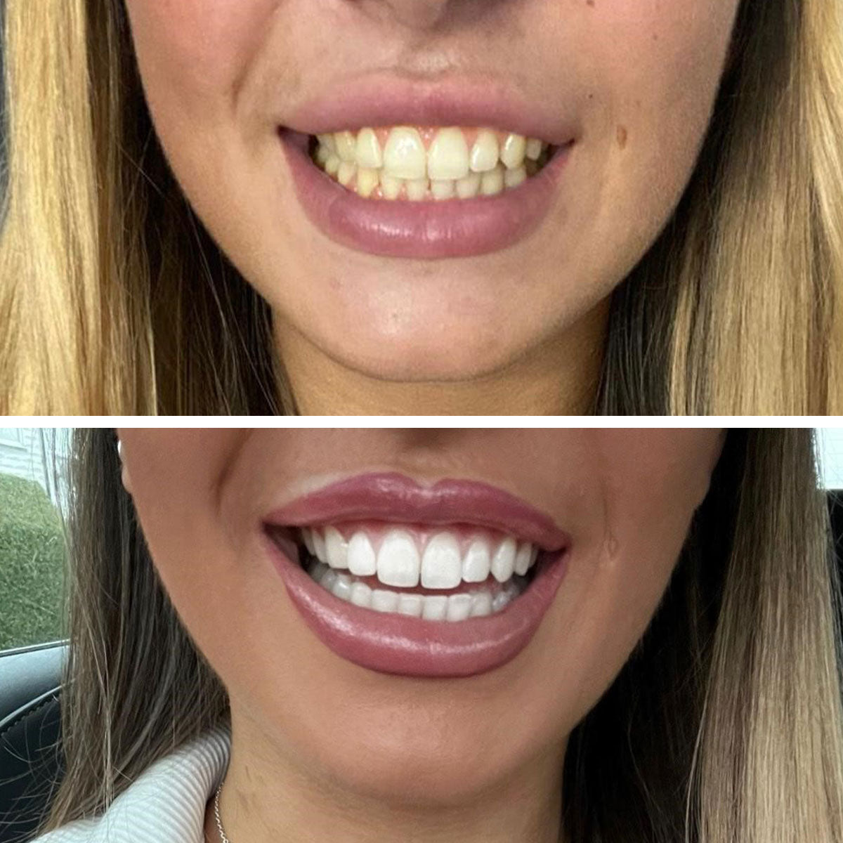 A Beautiful Smile Created With