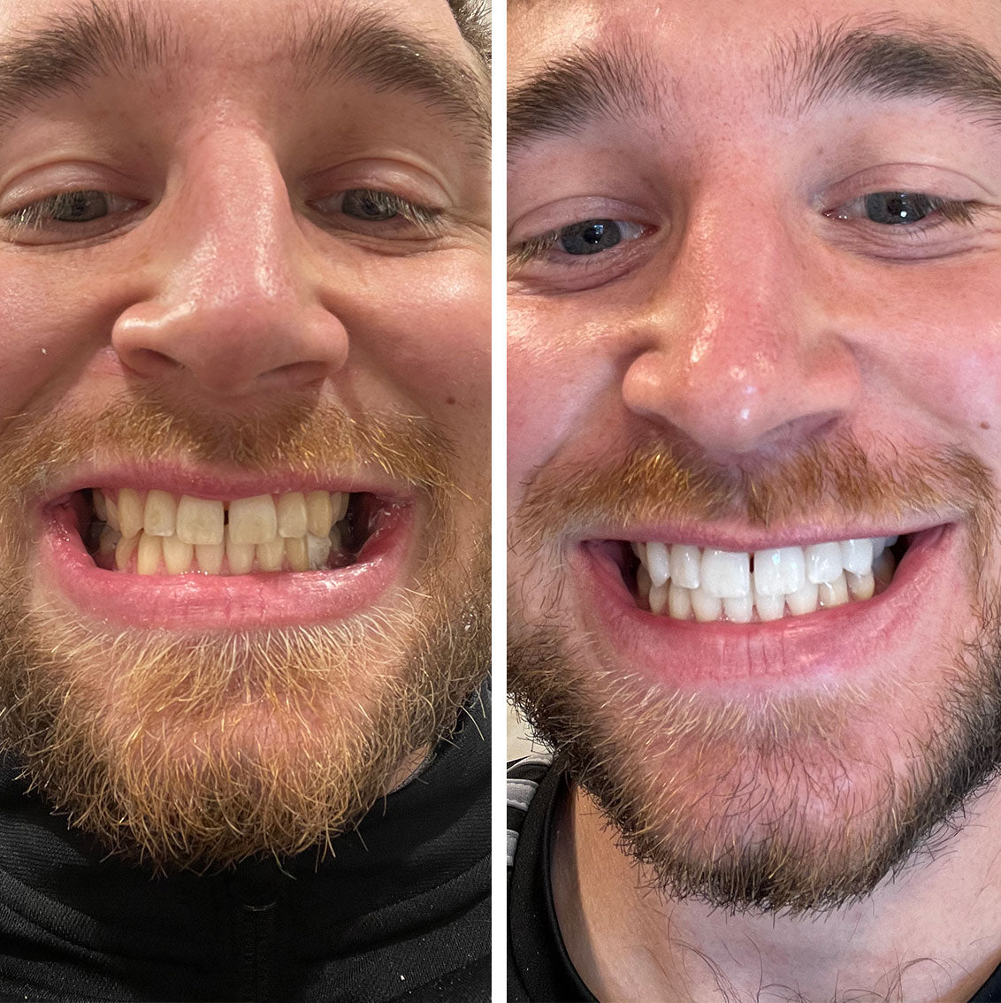 A Beautiful Smile Created With